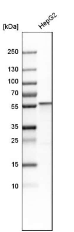 Aldehyde Dehydrogenase 1-A1/ALDH1A1 Antibody, Novus Biologicals:Antibodies:Primary