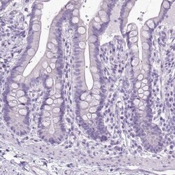 Aldehyde Dehydrogenase 3-A1/ALDH3A1 Antibody, Novus Biologicals:Antibodies:Primary