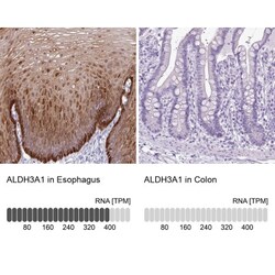 Aldehyde Dehydrogenase 3-A1/ALDH3A1 Antibody, Novus Biologicals:Antibodies:Primary