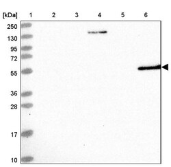 Aldehyde Dehydrogenase 3-A1/ALDH3A1 Antibody, Novus Biologicals:Antibodies:Primary