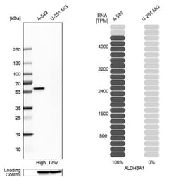 Aldehyde Dehydrogenase 3-A1/ALDH3A1 Antibody, Novus Biologicals:Antibodies:Primary