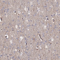 Aldehyde Oxidase 1/AOX1 Antibody, Novus Biologicals 0.1mL; Unlabeled:Antibodies,