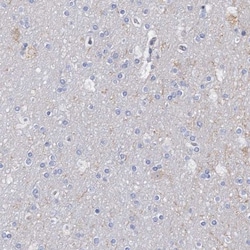 Aldehyde Oxidase 1/AOX1 Antibody, Novus Biologicals 25 &mu;L; Unlabeled:Antibodies,