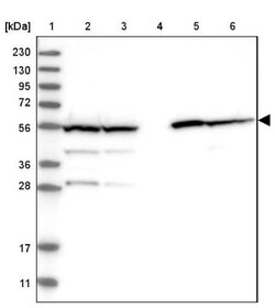 Aldehyde dehydrogenase 5 Antibody, Novus Biologicals:Antibodies:Primary