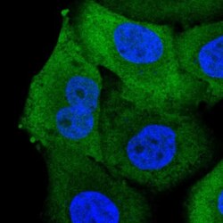 Aldo-keto Reductase 1B10/AKR1B10 Antibody, Novus Biologicals:Antibodies:Primary