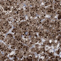 Aldo-keto Reductase 1B10/AKR1B10 Antibody, Novus Biologicals:Antibodies:Primary