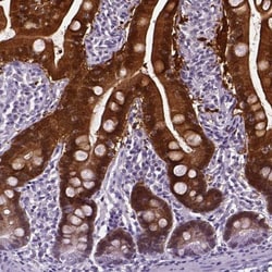 Aldo-keto Reductase 1B10/AKR1B10 Antibody, Novus Biologicals:Antibodies:Primary