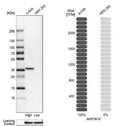 Aldo-keto Reductase 1B10/AKR1B10 Antibody, Novus Biologicals:Antibodies:Primary