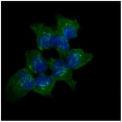 anti-Aldo-keto Reductase 1C1/AKR1C1, Clone: 6D10, Novus Biologicals 50uL;