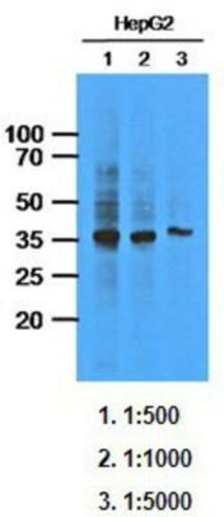 anti-Aldo-keto Reductase 1C1/AKR1C1, Clone: 6D10, Novus Biologicals 50uL;