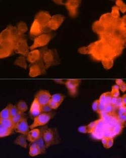 Aldo-keto Reductase 1C3/AKR1C3 Rabbit anti-Human, Mouse, Clone: 7T10F5,