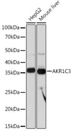 Aldo-keto Reductase 1C3/AKR1C3 Rabbit anti-Human, Mouse, Clone: 7T10F5,