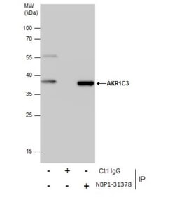 Aldo-keto Reductase 1C3/AKR1C3 Antibody, Novus Biologicals 0.1mg; Unlabeled:Antibodies,