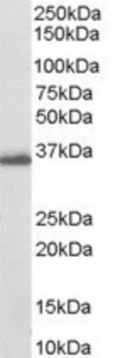 Aldo-keto Reductase 1C3/AKR1C3 Antibody, Novus Biologicals 0.1mg; Unlabeled:Antibodies,