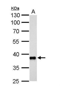 Aldo-keto Reductase 1C3/AKR1C3 Antibody, Novus Biologicals 0.1mg; Unlabeled:Antibodies,