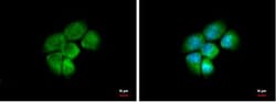 Aldo-keto Reductase 1C4/AKR1C4 Antibody, Novus Biologicals 0.1mL; Unlabeled:Antibodies,