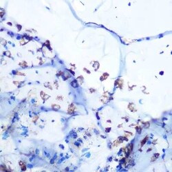 Aldolase A Rabbit anti-Human, Mouse, Rat, Clone: 4B2E5, Novus Biologicals 100 &mu;g | Buy Online | Novus Biologicals | Fisher Scientific