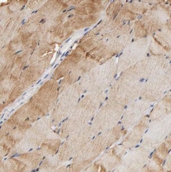 Aldolase A Antibody, Novus Biologicals:Anticorps:Anticorps primaires