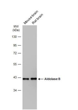 Aldolase B Antibody, Novus Biologicals 0.1mL; Unlabeled:Antibodies, Polyclonal