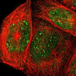 Aldolase C Antibody, Novus Biologicals:Antibodies:Primary Antibodies