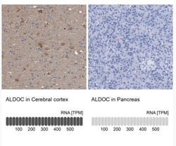 Aldolase C Antibody, Novus Biologicals:Antibodies:Primary Antibodies