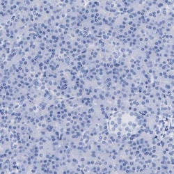 Aldolase C Antibody, Novus Biologicals:Antibodies:Primary Antibodies