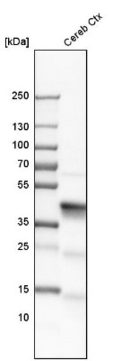 Aldolase C Antibody, Novus Biologicals:Antibodies:Primary Antibodies