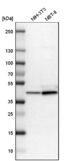 Aldolase C Antibody, Novus Biologicals:Antibodies:Primary Antibodies