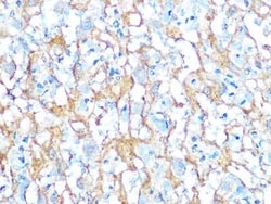 Alkaline Phosphatase/ALPP/ALPI Rabbit anti-Human, Mouse, Rat, Clone: 10Q2X7, Novus Biologicals 20 &mu;g | Buy Online | Novus Biologicals | Fisher Scientific