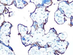 Alkaline Phosphatase/ALPP/ALPI Rabbit anti-Human, Mouse, Rat, Clone: 10Q2X7, Novus Biologicals 20 &mu;g | Buy Online | Novus Biologicals | Fisher Scientific