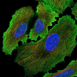 Alkaline Phosphatase/ALPP Antibody, Novus Biologicals:Antibodies:Primary