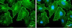 Alpha Actinin 2 Antibody, Novus Biologicals 0.1mL; Unlabeled:Antibodies,