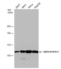 Alpha Actinin 2 Antibody, Novus Biologicals 0.1mL; Unlabeled:Antibodies,