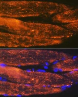 Alpha Actinin 3 Rabbit anti-Human, Mouse, Rat, Clone: 4H7E6, Novus Biologicals
