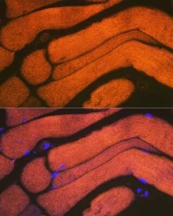 Alpha Actinin 3 Rabbit anti-Human, Mouse, Rat, Clone: 4H7E6, Novus Biologicals