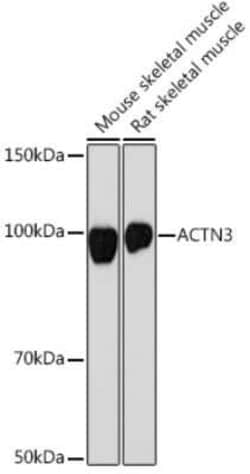 Alpha Actinin 3 Rabbit anti-Human, Mouse, Rat, Clone: 4H7E6, Novus Biologicals