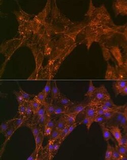 Alpha Actinin 4 Rabbit anti-Human, Mouse, Rat, Clone: 5Y3R6, Novus Biologicals