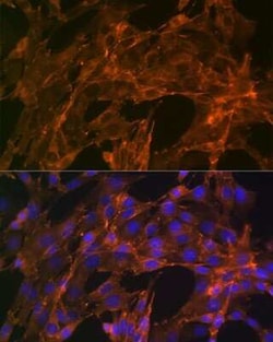 Alpha Actinin 4 Rabbit anti-Human, Mouse, Rat, Clone: 5Y3R6, Novus Biologicals