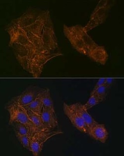 Alpha Actinin 4 Rabbit anti-Human, Mouse, Rat, Clone: 5Y3R6, Novus Biologicals