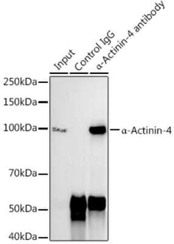 Alpha Actinin 4 Rabbit anti-Human, Mouse, Rat, Clone: 5Y3R6, Novus Biologicals