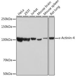 Alpha Actinin 4 Rabbit anti-Human, Mouse, Rat, Clone: 5Y3R6, Novus Biologicals