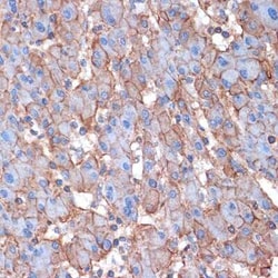 Alpha Fodrin Rabbit anti-Human, Mouse, Rat, Clone: 9H5V8, Novus Biologicals:Antibodies:Primary