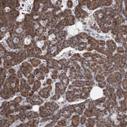 Alpha-mannosidase II Antibody, Novus Biologicals 0.1mL; Unlabeled:Antibodies,