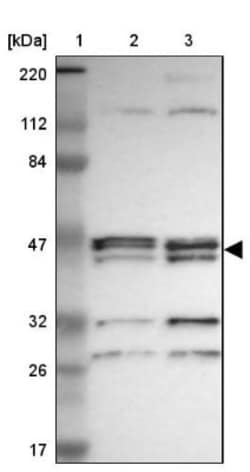 Alpha-parvin/Actopaxin Antibody, Novus Biologicals:Antibodies:Primary Antibodies