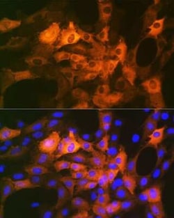AlphaB Crystallin/CRYAB Rabbit anti-Human, Rat, Clone: 6C9R1, Novus Biologicals:Antibodies:Primary