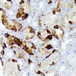AlphaB Crystallin/CRYAB Rabbit anti-Human, Rat, Clone: 6C9R1, Novus Biologicals:Antibodies:Primary