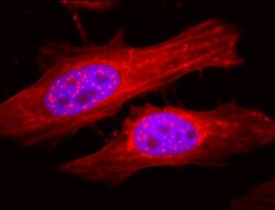 AlphaB Crystallin/CRYAB Antibody, Novus Biologicals 0.025 mL, Unconjugated:Antibodies,