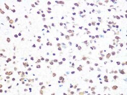 Aly Rabbit anti-Human, Mouse, Rat, Clone: 6I4T10, Novus Biologicals 100
