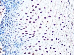Aly Rabbit anti-Human, Mouse, Rat, Clone: 6I4T10, Novus Biologicals 100