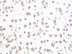 Aly Rabbit anti-Human, Mouse, Rat, Clone: 6I4T10, Novus Biologicals 100